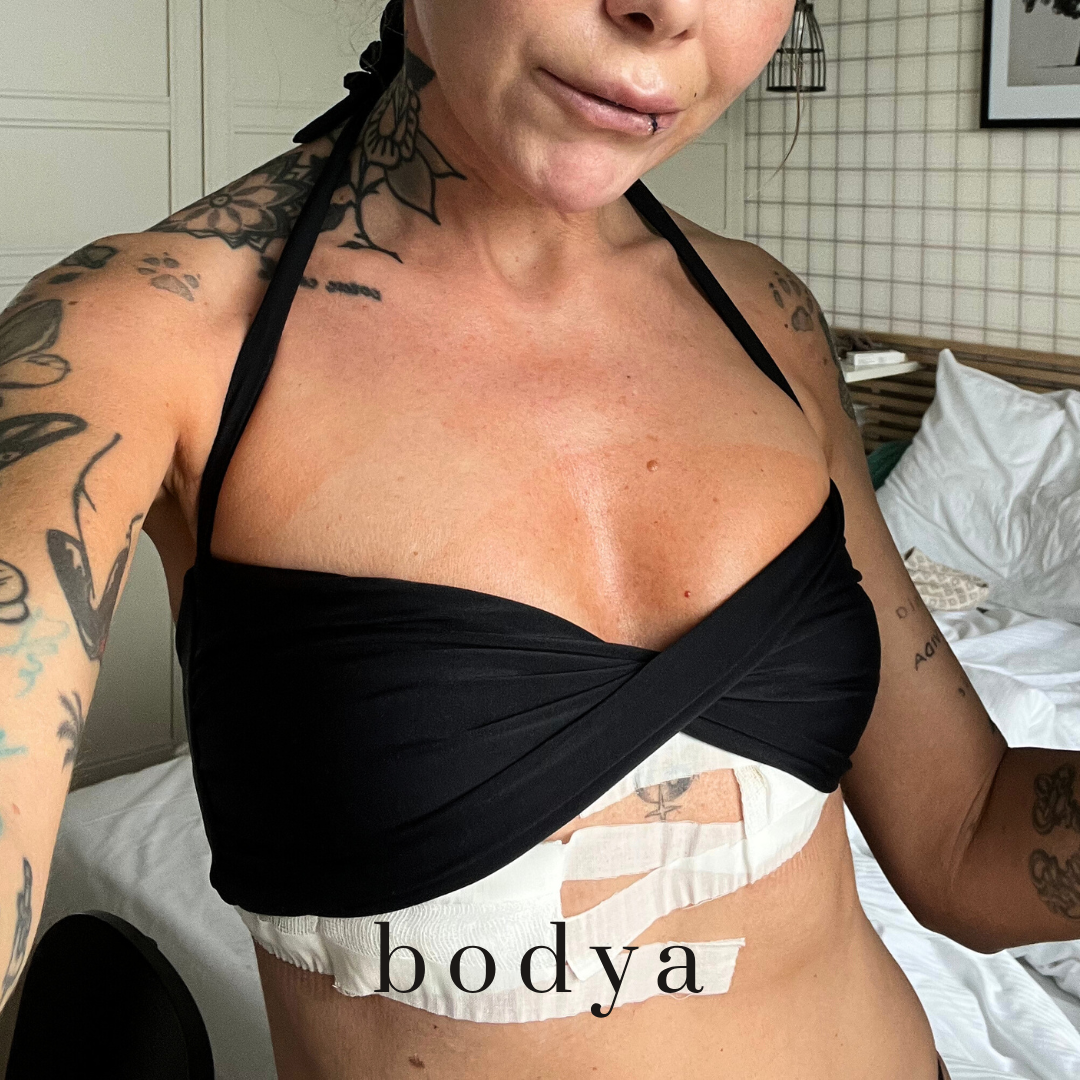 To samo bikini, inny biust: moja podróż przed i po usunięciu implantów